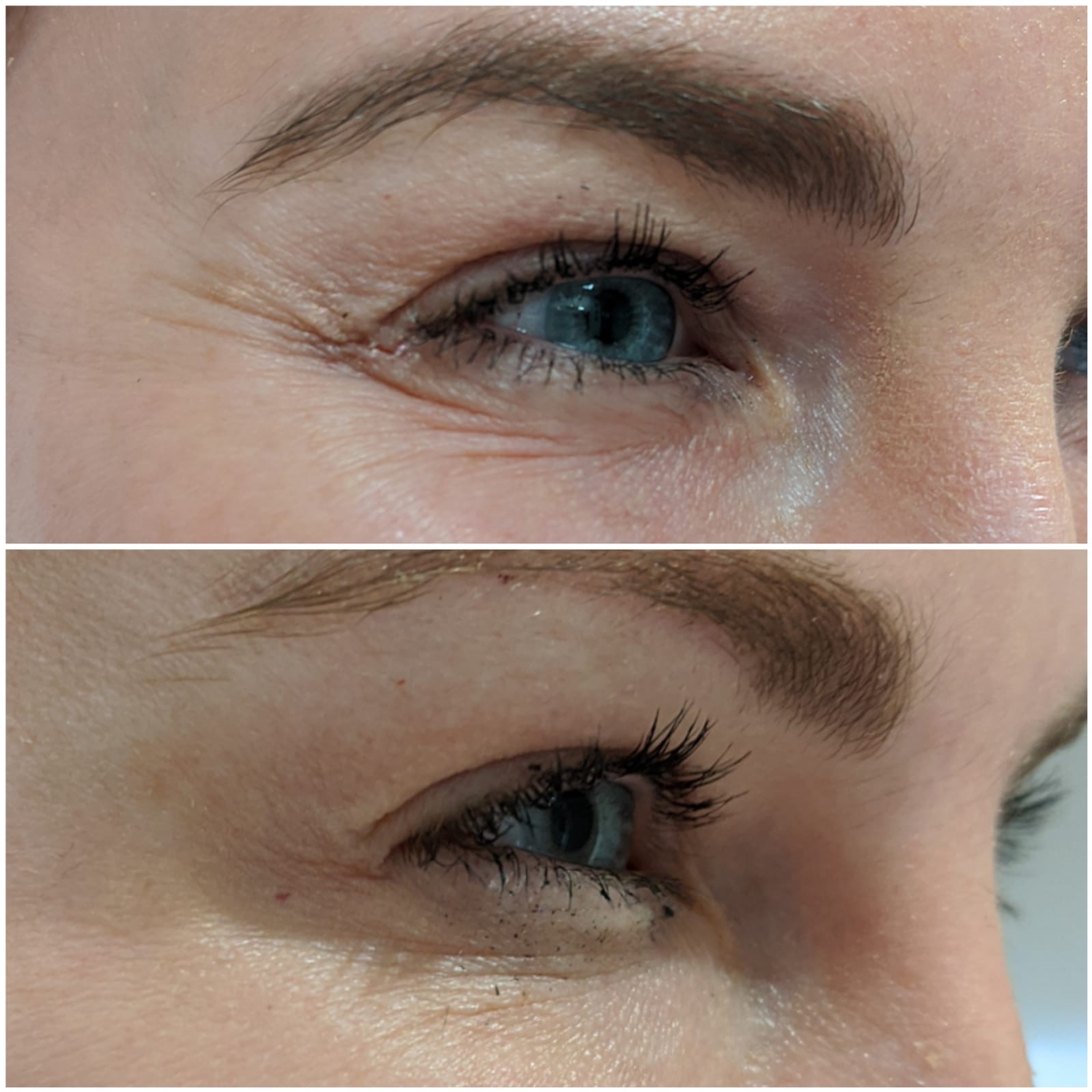 an image showing crowlines before and after
